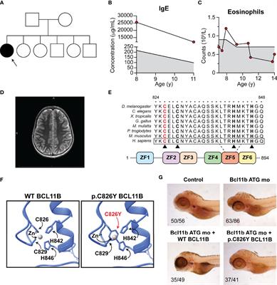 A Novel Germline Heterozygous BCL11B Variant Causing Severe Atopic Disease and Immune Dysregulation